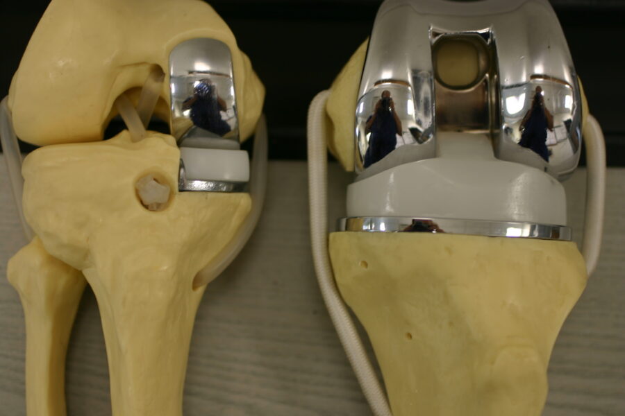 How many knee replacements per year?