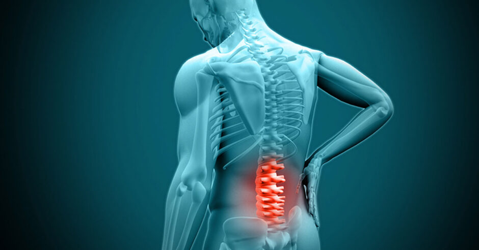  Rehabilitation For Lumbar Decompression Surgery Recovery