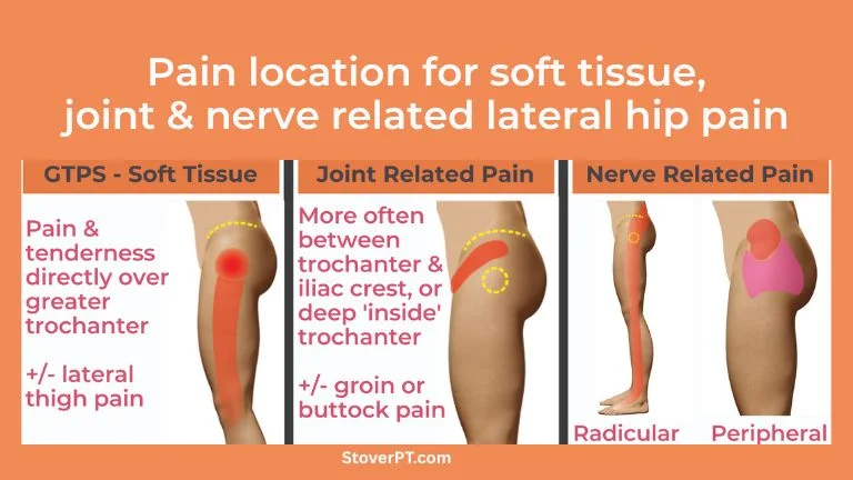 Lateral Hip Pain