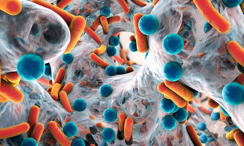  What Is Biofilm? Why This Might Be the Missing Link in Your Chronic Health Issues